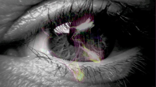 Eye